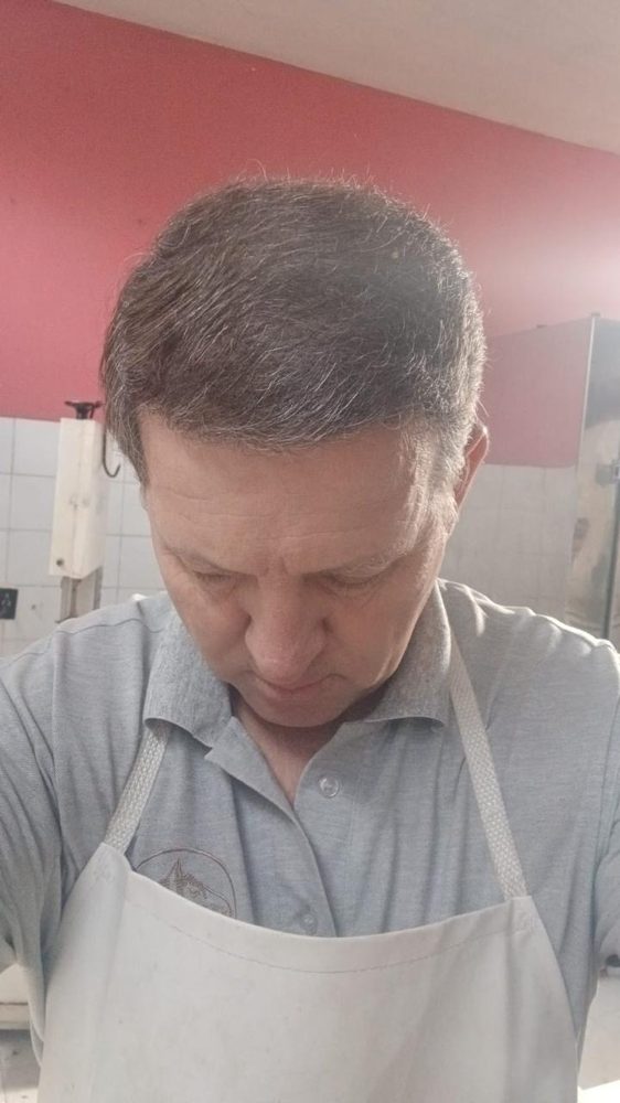 Paciente con el cabello restaurado